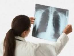 Hökumətin siyasəti pnevmoniyanı qorxulu xəstəliyə çevirib