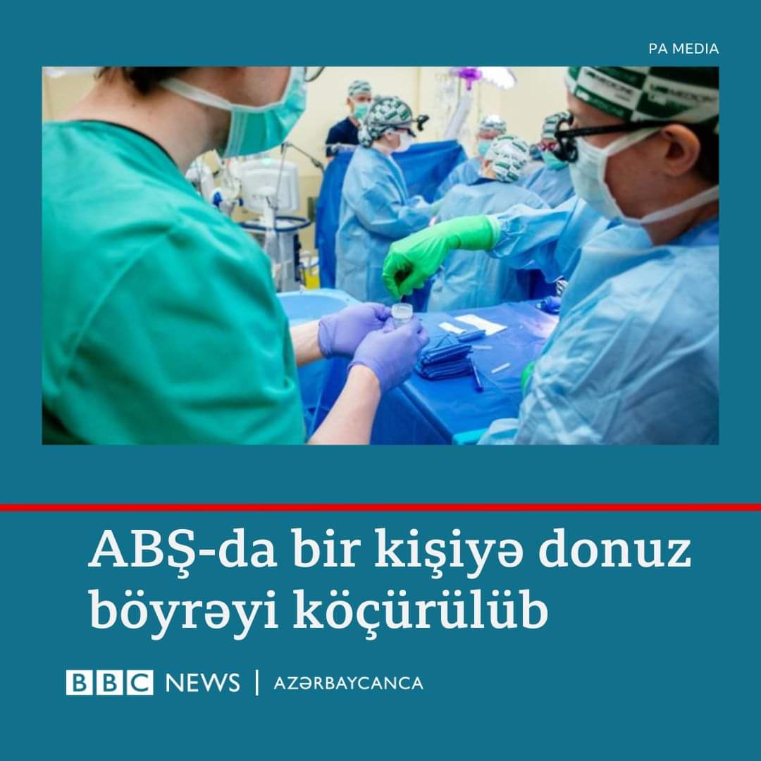 İnsana donuz böyrəyi köçürüldü